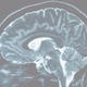MSU Scientists open window into psychosis